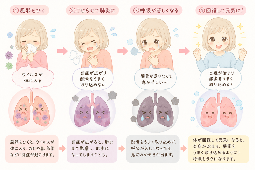 alt="風邪から肺炎になり呼吸が苦しくなる原因と、回復して酸素を取り込めるようになるまでの流れを、肺のイラストとともにわかりやすく説明した図。"